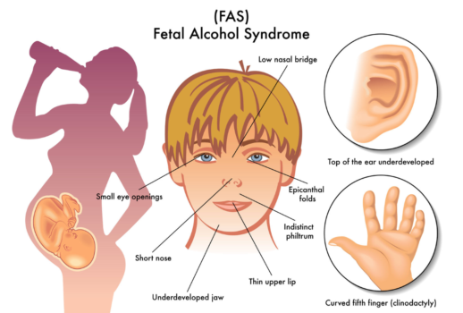 morris-healthcare-services-fasd