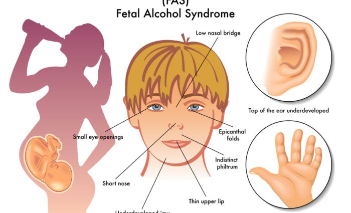 morris-healthcare-services-fasd